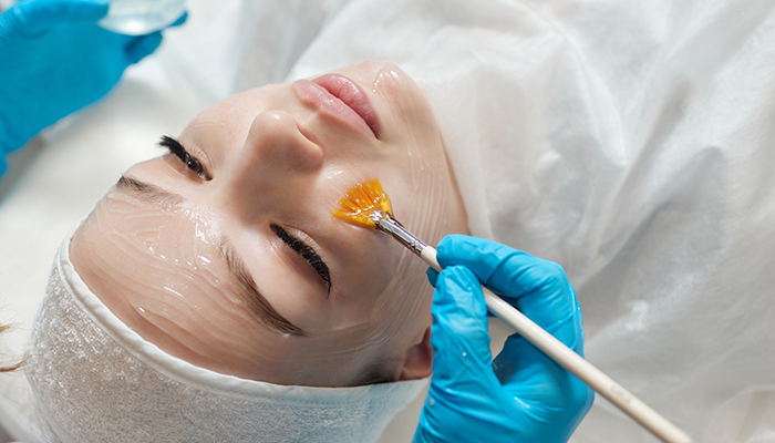 Chemical Peel Treatment