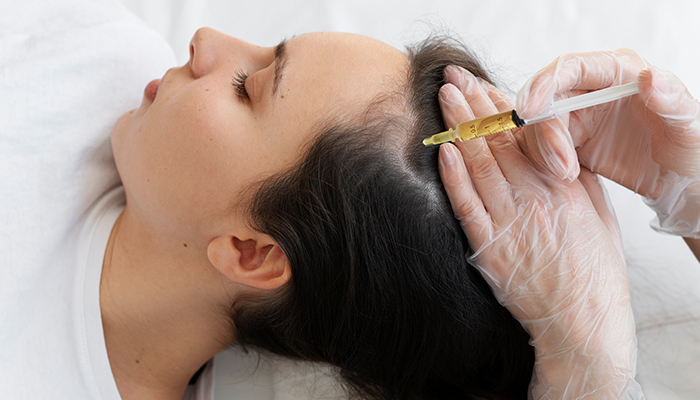 PRP Hair Loss Treatment