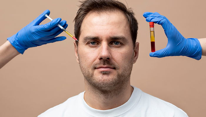 PRP Hair Loss Procedure